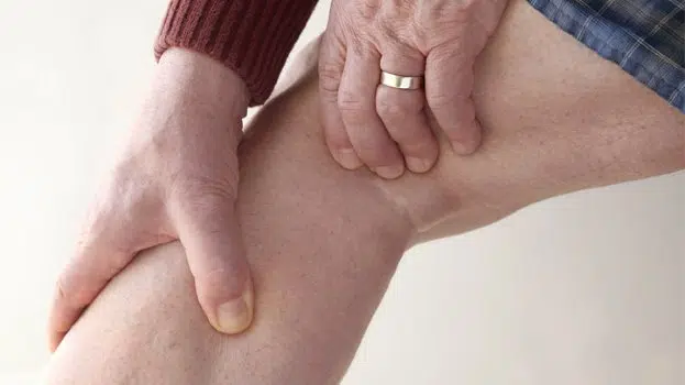 The Causes of Deep Vein Thrombosis