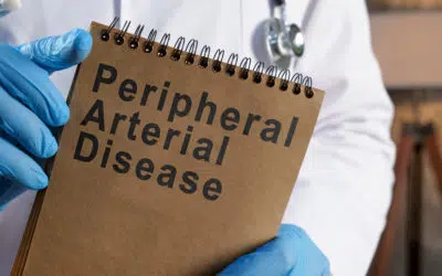 7 Facts About Arterial Disease: Key Insights on Peripheral Arterial Disease (PAD)