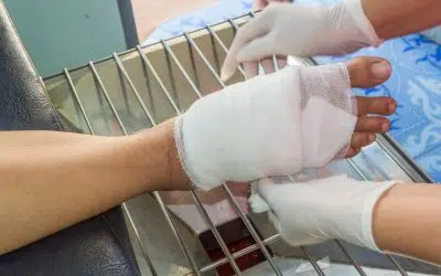 Everything You Need To Know About Gangrene