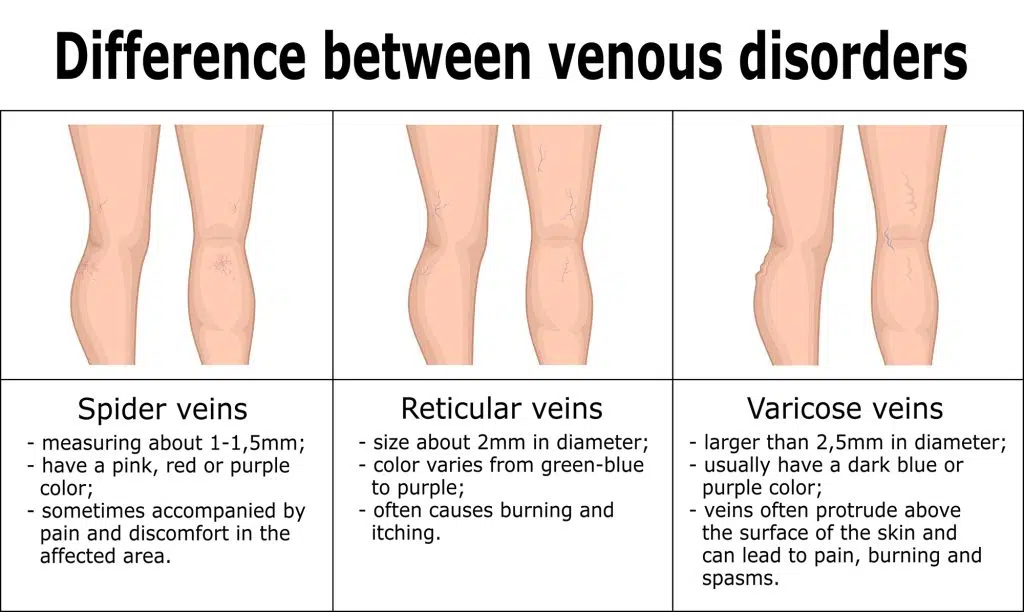 Difference between venous disorders