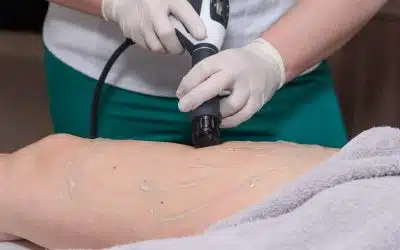 Understanding and Treating Post-Inflammatory Hyperpigmentation on Legs