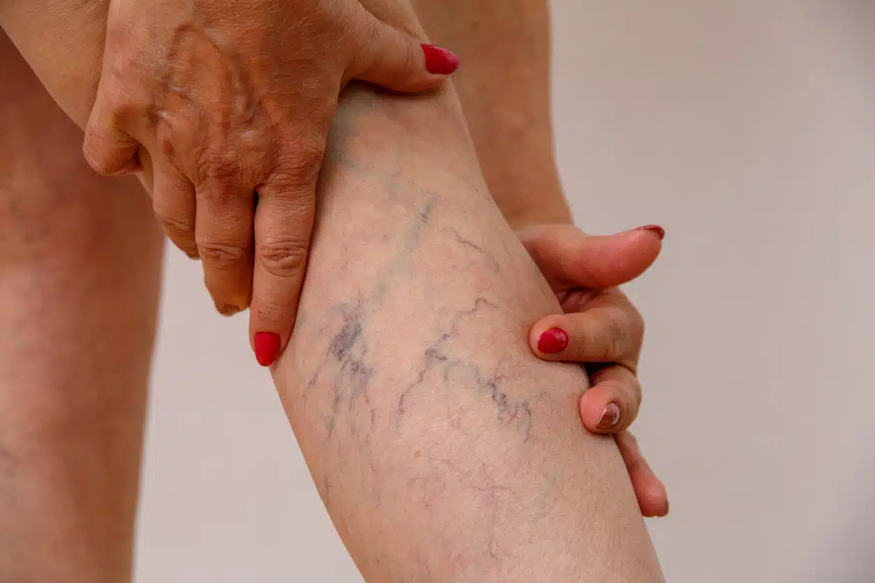 Blue vs green veins
