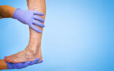 What Is Venous Insufficiency Disease